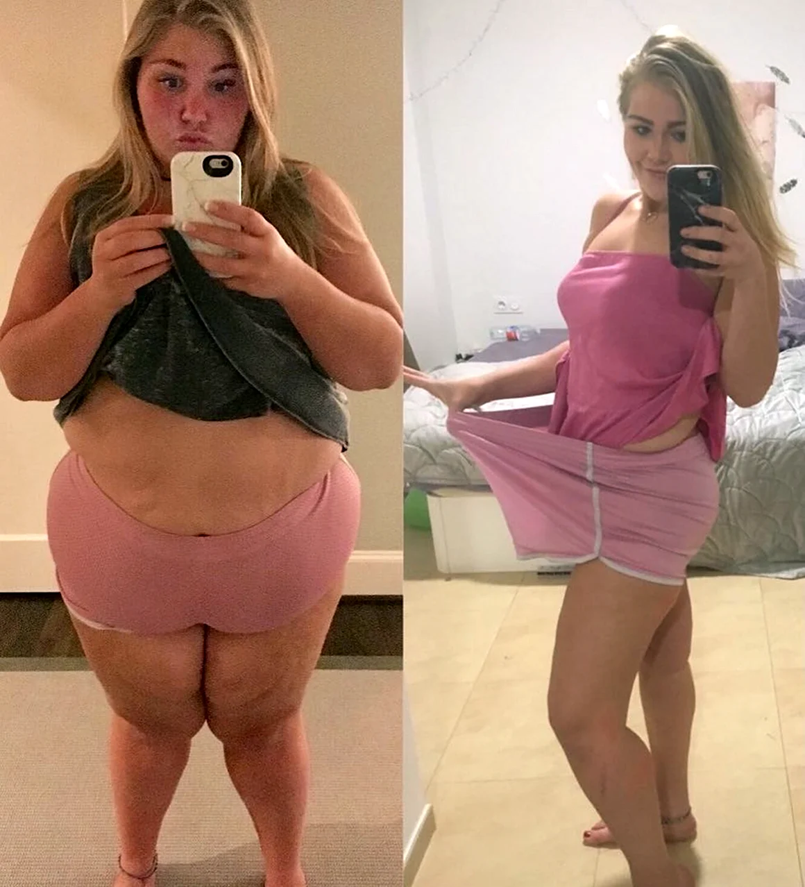 До и после похудения девушки