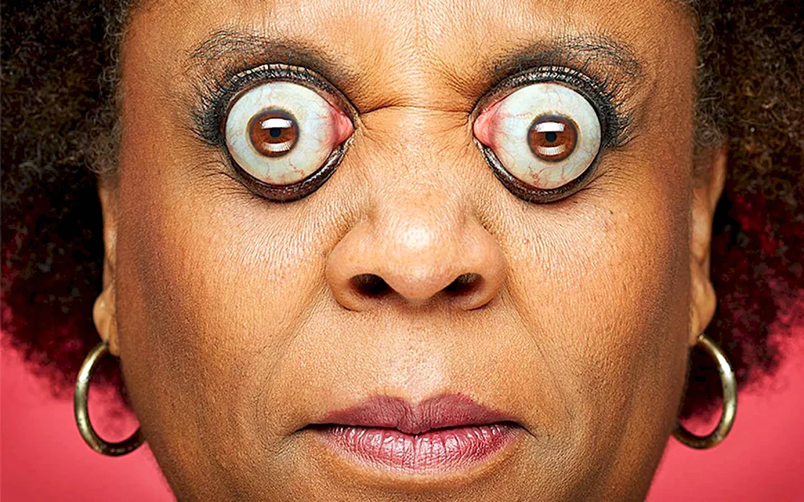 Ким Гудман- самые большие глаза в мире