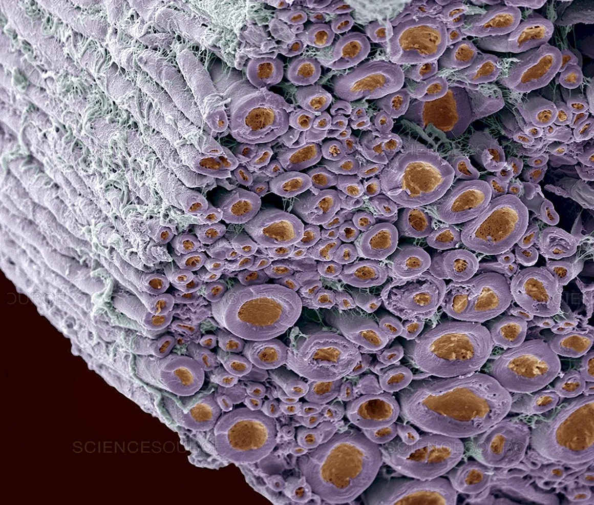Костная ткань микрофотография