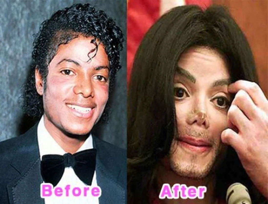 Майкл Джексон до пластических операций